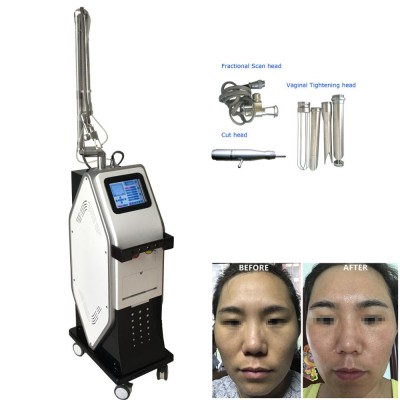 2019 professional fractional co2 laser machine/radio frequency vaginal tightening machine